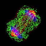 Microscope image of chromosomes separating during cell division.