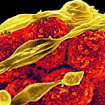 Methicillin-resistant Staphylococcus aureus bacteria