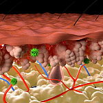 Illustration of inflamed skin shows layers affected by reactive oxygen species.