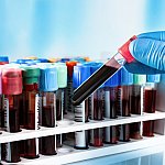 Gloved hand holding a test tube with a blood sample.