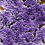 Digitally colorized scanning electron microscopic image showing large field of Enterococcus bacteria.