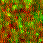Microscopic image of a retina.