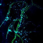Confocal microscopy image shows Treg cells clustered next to long nerve cells.