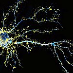 Fluorescence microscopy image of a cortical neuron.
