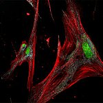 Microscope image of long cells with visible fibers inside.
