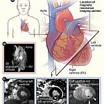 3 panel image showing different methods of viewing the heart.