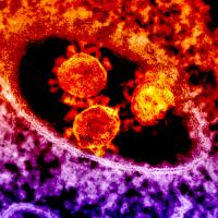 Microscopic image of MERS coronavirus particles.