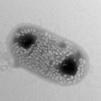 Transmission electron micrograph image of a genetically engineered E. coli bacterium.