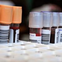Blood tubes in laboratory