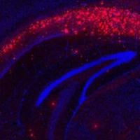 Amyloid-beta in mouse brain