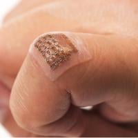 Patch stretched on a finger joint.