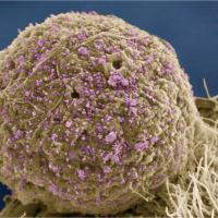HIV-infected cell