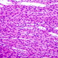 Histological image of heart muscle