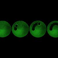  Robot clearing biofilm from a tube