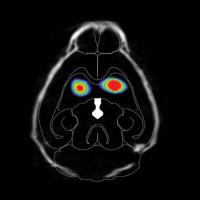 Brains of mice injected with misfolded alpha-synuclein have less dopamine.