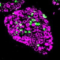Nerves labelled green scattered among magenta ones