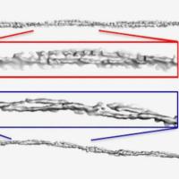 Alpha-synuclein fibrils from people with PD and MSA show different levels of twisting.