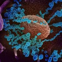 SARS-CoV-2 virus particles