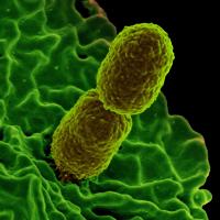 Klebsiella pneumoniae on surface of human neutrophil