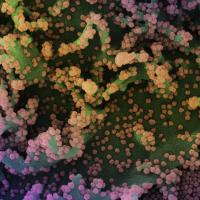 Novel Coronavirus SARS-CoV-2