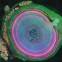 Photograph of retina