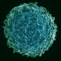Colorized scanning electron micrograph of a B cell