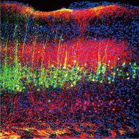 Neurons in a mouse brain’s auditory cortex