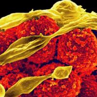 Methicillin-resistant Staphylococcus aureus bacteria