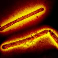Influenza A Virus (H5N1/Bird Flu)