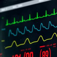 Image of a bedside ICU heart monitor.