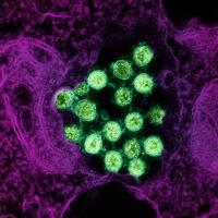 Novel Coronavirus SARS-CoV-2 (Omicron)