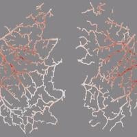 Illustration of blood vessels in the mouse brain