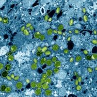 Colorized transmission electron micrograph of mpox virus particles