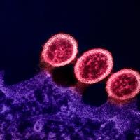 Transmission electron micrograph of HIV-1 virus particles