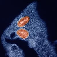 Two oblong shapes clustered close to each other within an irregular mass.