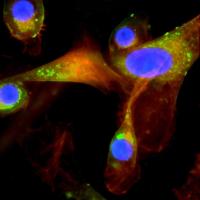 Oral pathogen invasion of human gum cells
