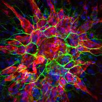 Choroidal neovascularization