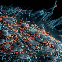 Scanning electron micrograph of Lassa virus budding off a cell. 