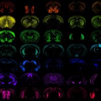 Multiple images of the mouse brain on a black background with various cells highlighted to portray the precision access of new genetic tools developed. 