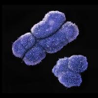 X and Y chromosomes.