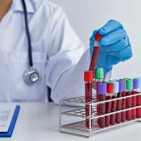 A medical laboratory scientist analyzing blood samples.