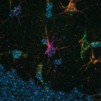Astrocytes.