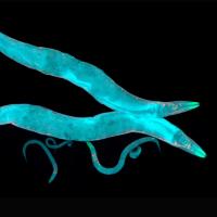 An illustration of Caenorhabditis elegans (C. elegans) under a microscope