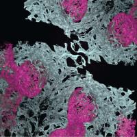 Microscope image showing six clusters of air sacs surrounded by blood vessels.