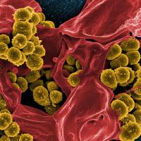 Colorized scanning electron micrograph of methicillin-resistant Staphylococcus aureus (MRSA) bacteria (gold) interacting with a human neutrophil (red). Image captured at NIAID's Rocky Mountain Laboratories (RML) in Hamilton, Montana.