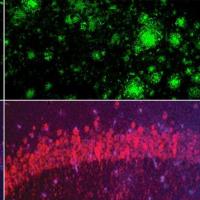 Four images of mouse brain cells.