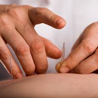 Close-up image of a practitioner placing an acupuncture needle