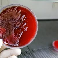 Staphylococcus growing in blood agar dish.