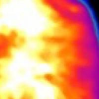 Infrared images show less heat in the brown fat of a mouse without ACOX2. 