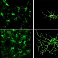 Image of cells in mouse brain. 